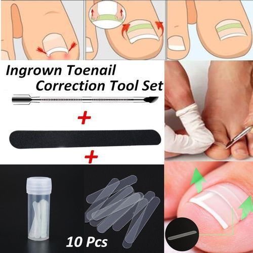 10-Piece Ingrown Toenail Correction Sticker Set