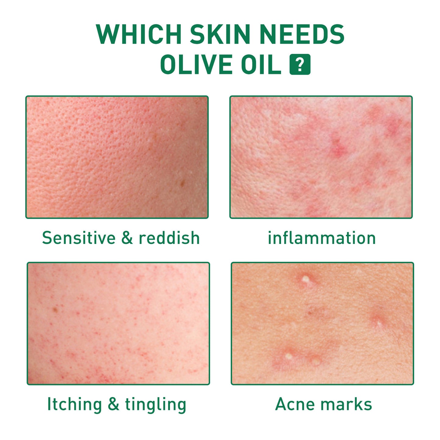 Tea Tree Oil Facial Skin Cleaning And Repair