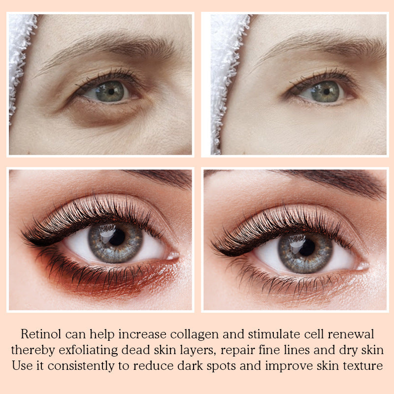 Eye Mask Fades Dark Circles, Nourishes The Eyes and Improves Fine Lines