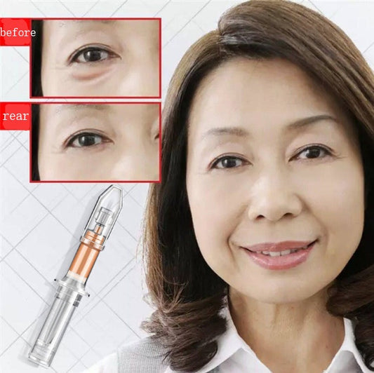 Eye Cream for Fine Lines, Dark Circles & Eye Bags