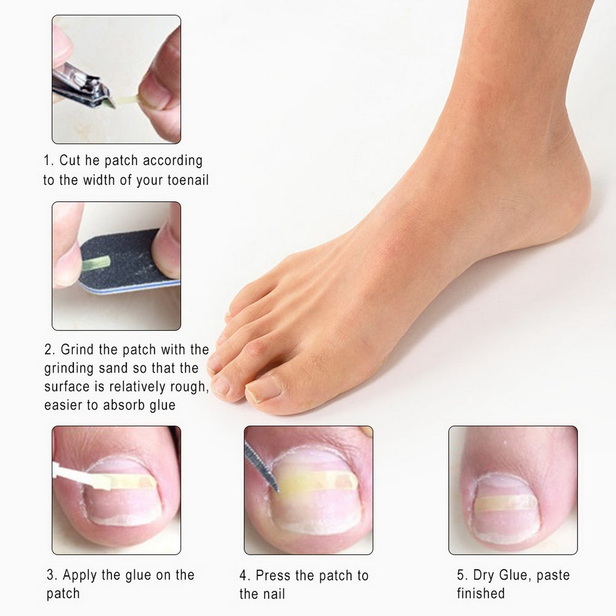 10-Piece Ingrown Toenail Correction Sticker Set